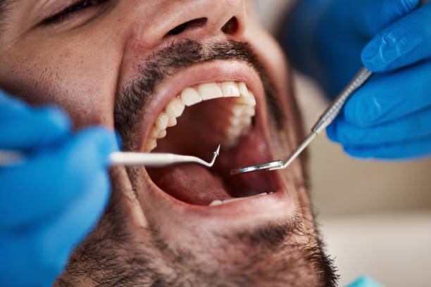 Best Chipped Tooth Repair Near Me  in Forestville, MD